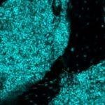 Scientists discover new 'immune hubs' in skull bone marrow