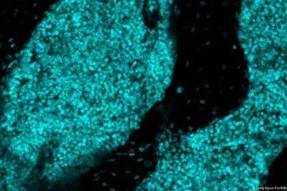 Scientists discover new 'immune hubs' in skull bone marrow